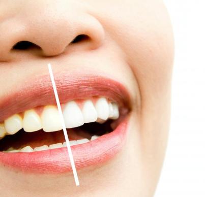 5 Ways to Use Before-and-After Photos to Boost Case Acceptance