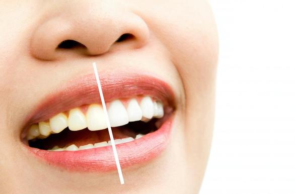 5 Ways to Use Before-and-After Photos to Boost Case Acceptance